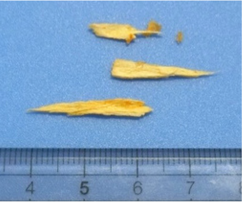 とう立ちしたにんじん